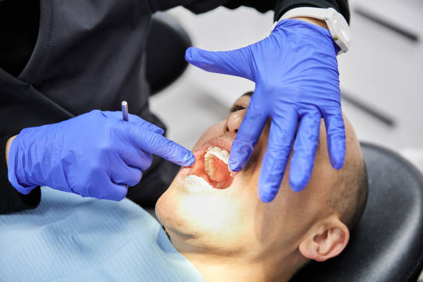 Best Emergency Wisdom Teeth Removal in University At Buffalo, NY