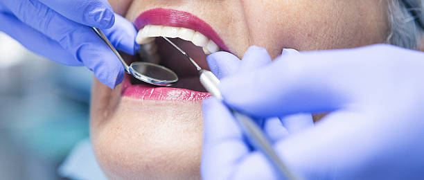 Best Same-Day Emergency Dentist in University At Buffalo, NY